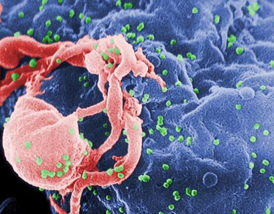 Un tercer enfermo de SIDA ha sido declarado limpio del virus tras someterse a un tratamiento experimental.