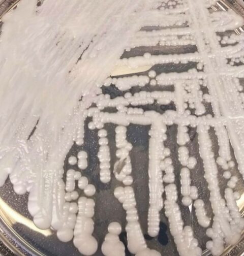 Una muestra del hongo Candida auris